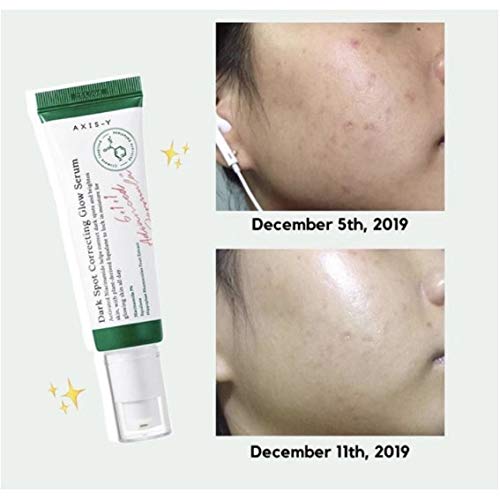 AXIS-Y Dark Spot Correcting Glow Serum