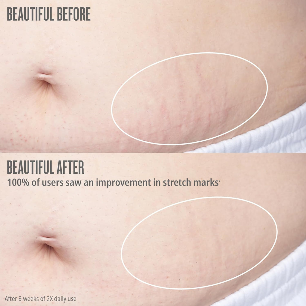 Sol de Janeiro Bum Bum Firmeza Body Oil - Stretch Mark Oil