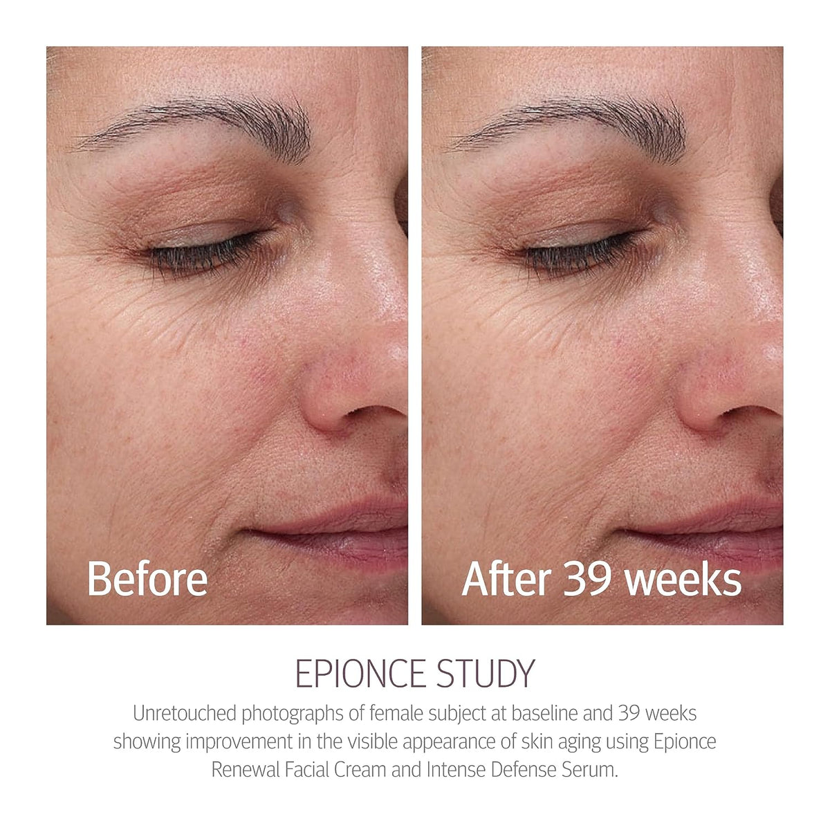 Epionce Renewal Facial Cream – Hydrating Anti-Aging Moisturizer | For Dry, Sensitive to Normal Skin | Fine Lines & Wrinkles | Dermatologist Skincare