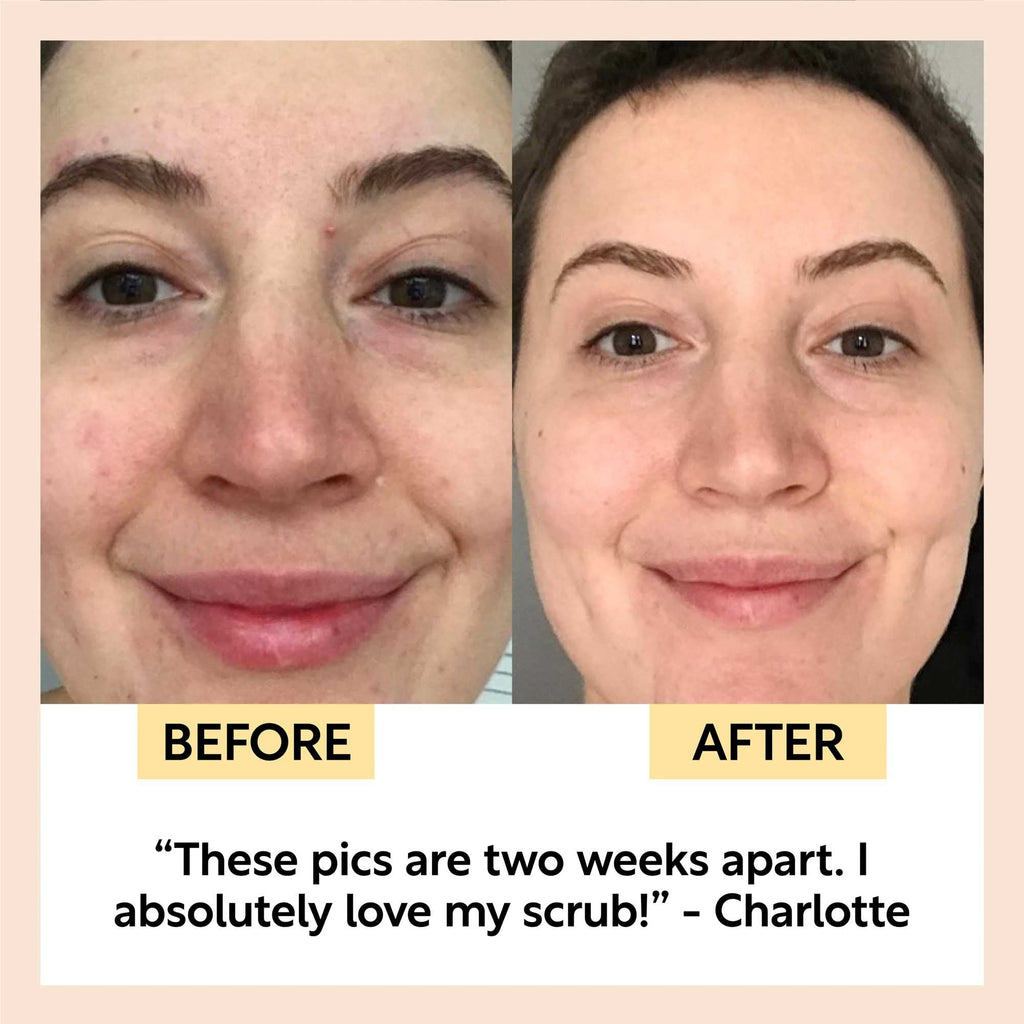 Face Scrub with Coffee + Rosehip Oil