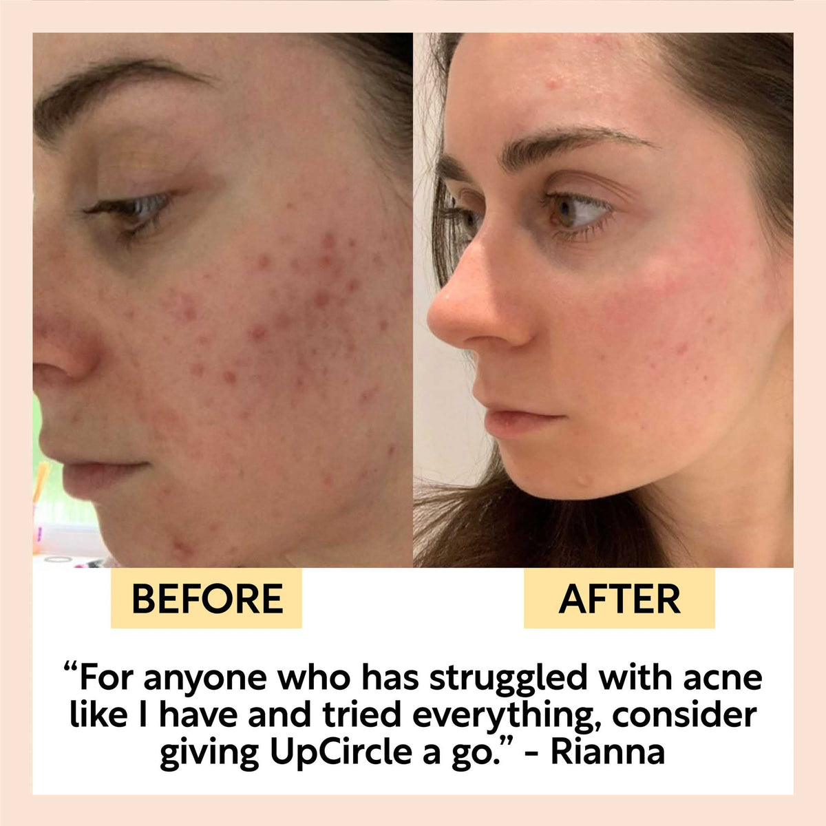 Face Toner with Hyaluronic Acid