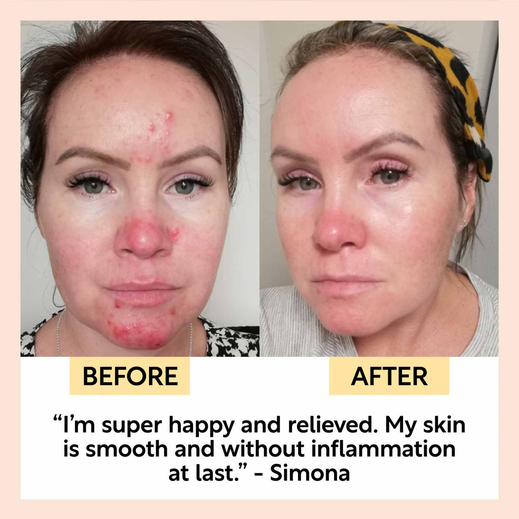 The Sensitive Skin Bundle