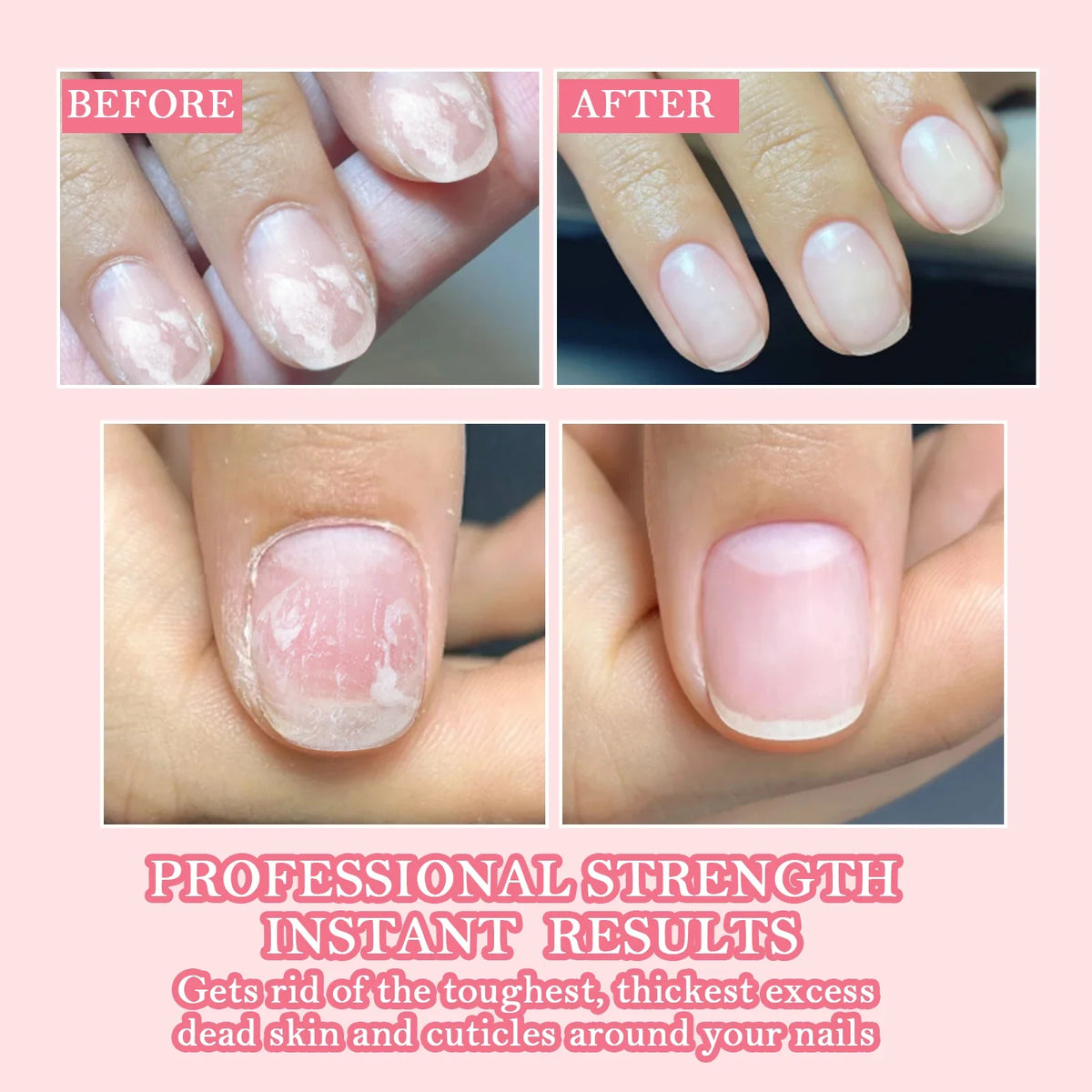 20ml Strong Nail Strengthener Calcium Protein Formula Strong Nails Hardener Protect Soft Thin Nails High Quality Repair Suppli