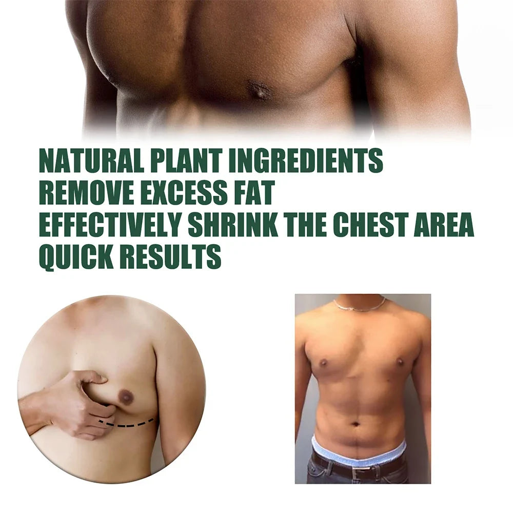 Gynecomastia Tightening Ginger Cream Weight Loss Cream Abdominal Muscle Fat Reduction Cream Fat Burning Cream For Men Women 30ml