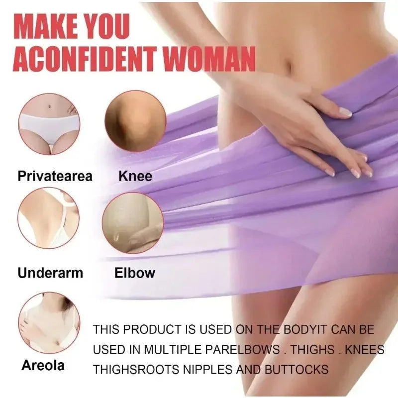 Whitening Cream Private Parts Underarm Bleaching Whiten Butt Knee Brighten Inner Thigh Intimate Parts Dark Remove Melanin