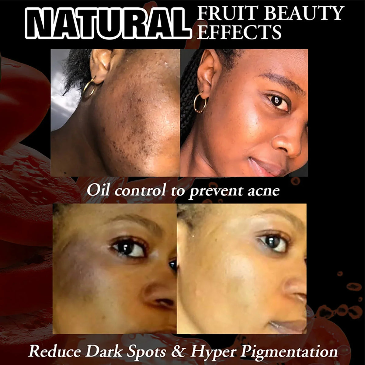 LKIAE Whitening Reduce Dark Spots & Hyperpigmentation Facial Brightening Vitamin C Bar Soap For The Skin Care