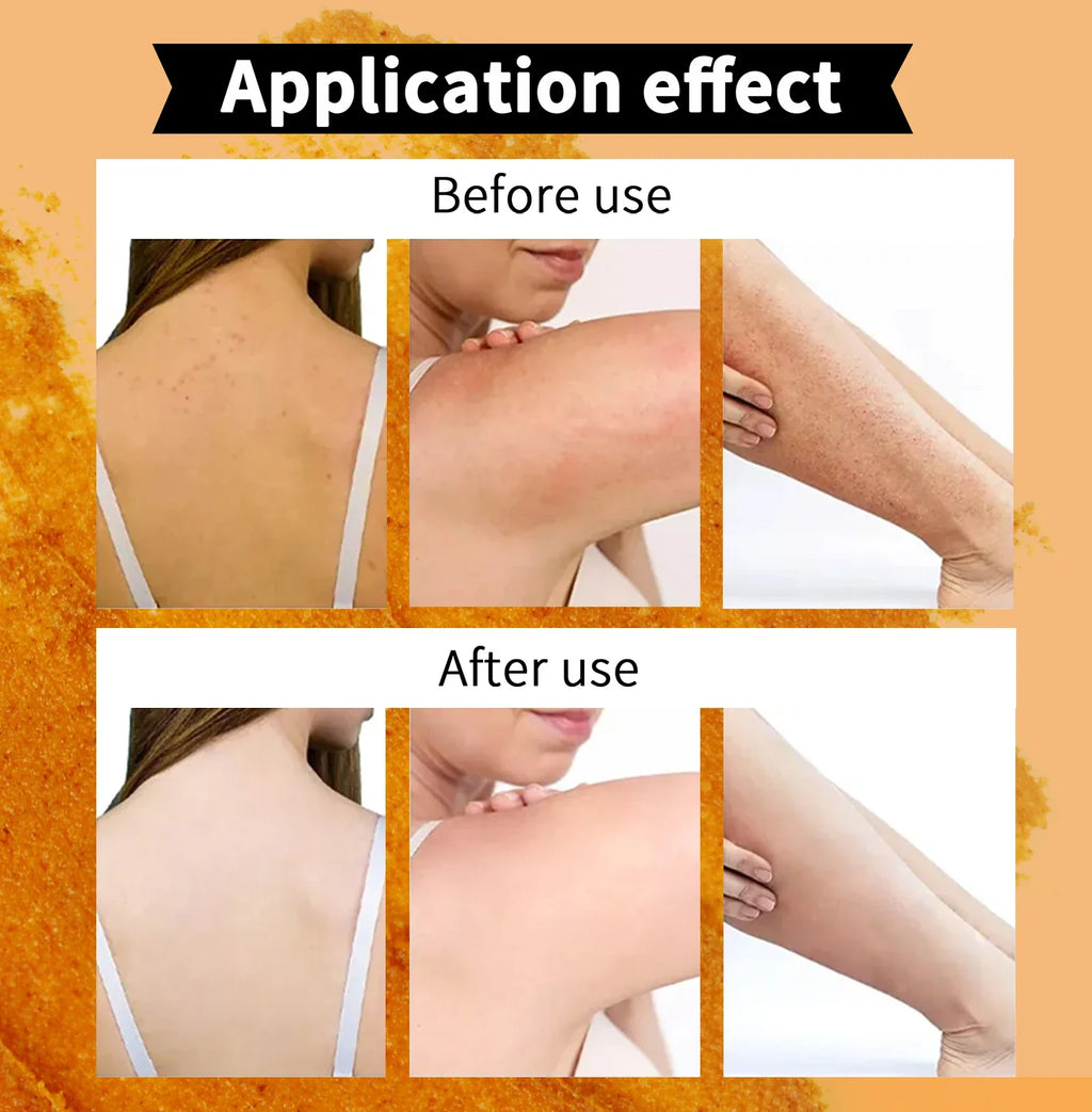 Natural Turmeric Scrub, For Face & Body, Brightening, Reduce Acne, Clean And Smooth Skin, Deeply Exfoliates, 250g/8.8 oz