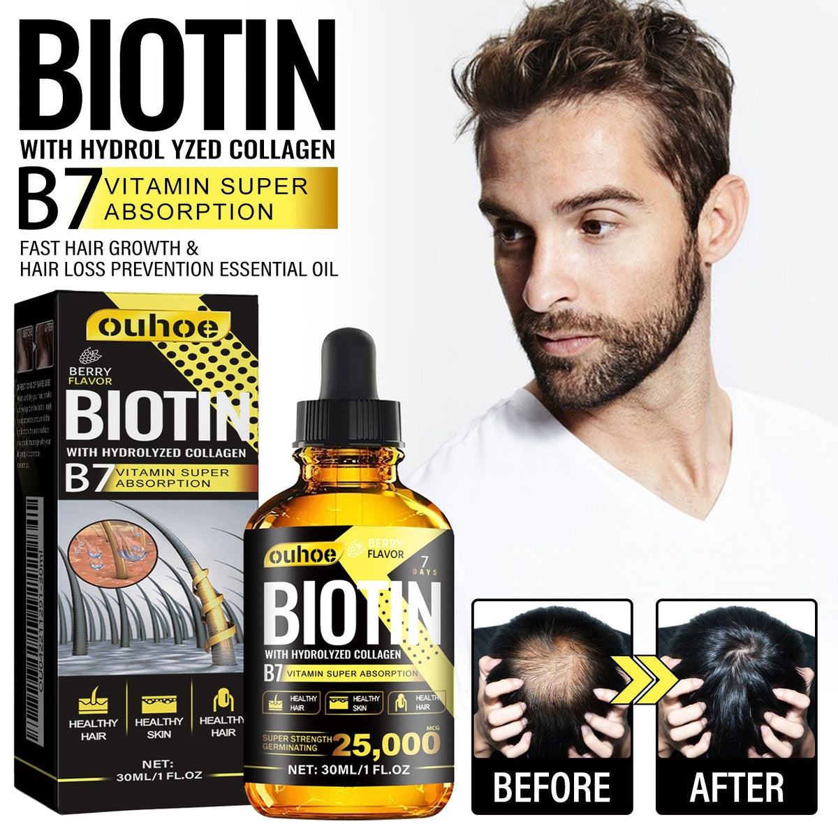 OUHOE Collagen B7 Vitamin Hair Care Essential Oil Nourishes Hair Gently And Softens Hair